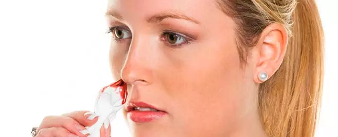 течет кровь из носа