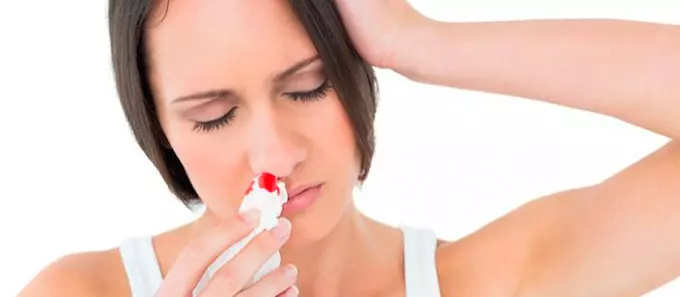 кровь из носа