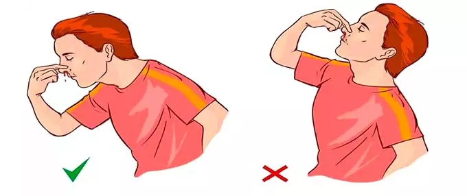 положение при кровотечении из ноздри