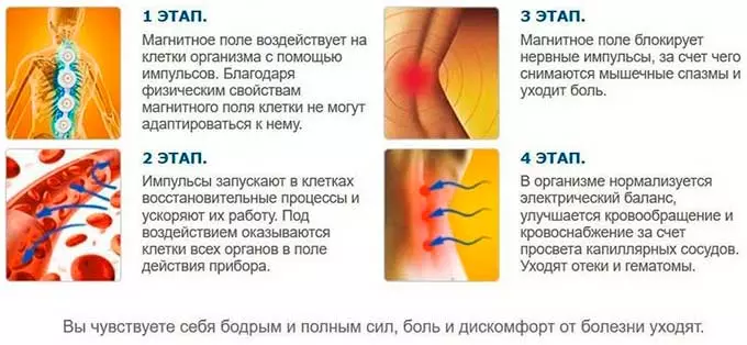 этапы лечения алмагом