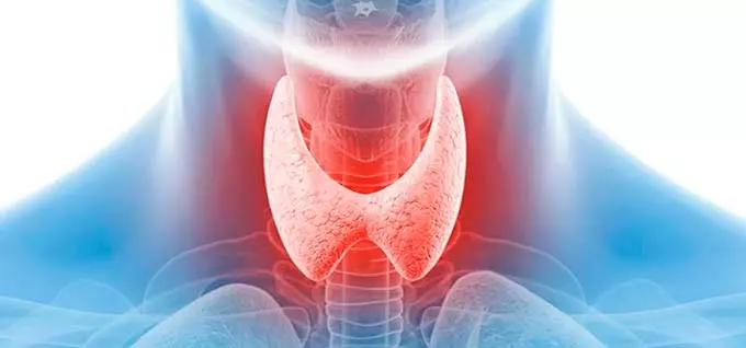 щитовидная железа