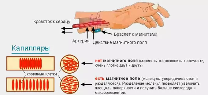 лечебные свойства магнитных браслетов