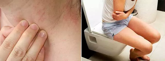 Возможный вред и побочные действия сыпь и запор