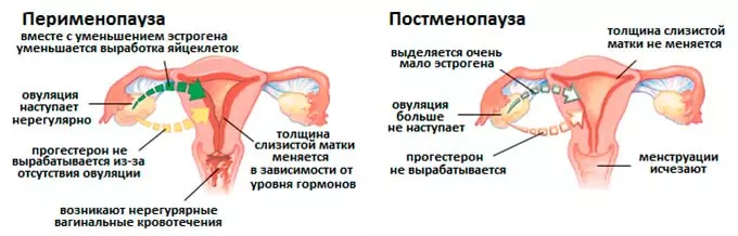 яичники при климаксе