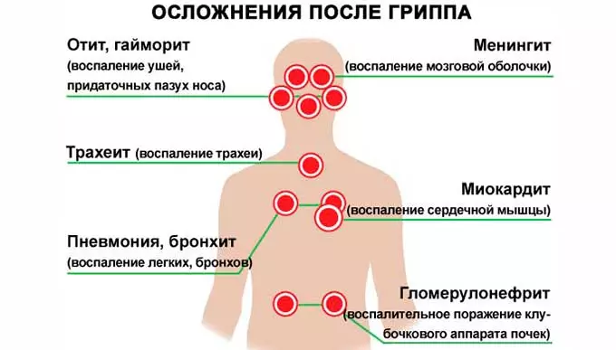 Изменение давления после перенесенной болезни осложнения гриппа