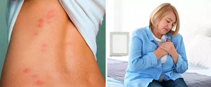 аллергия и боли в сердце