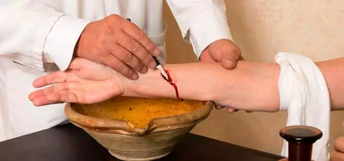 флеботомия