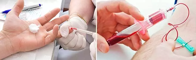 В каких случаях гипертоники допускаются к сдаче крови сдача крови