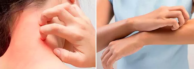 реакция на лекарство