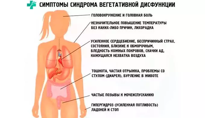 симптомы ВСД