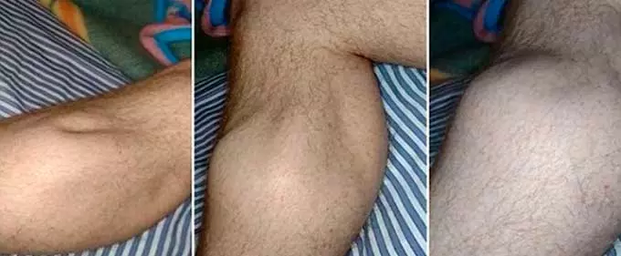 судорога ноги