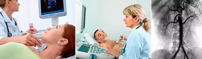 узи и кт сосудов