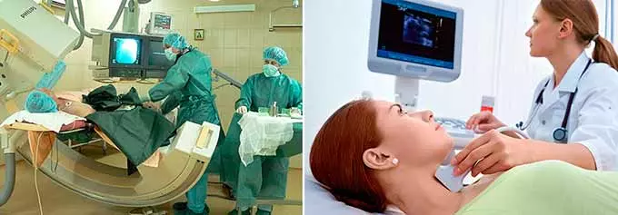 диагностика сосудов