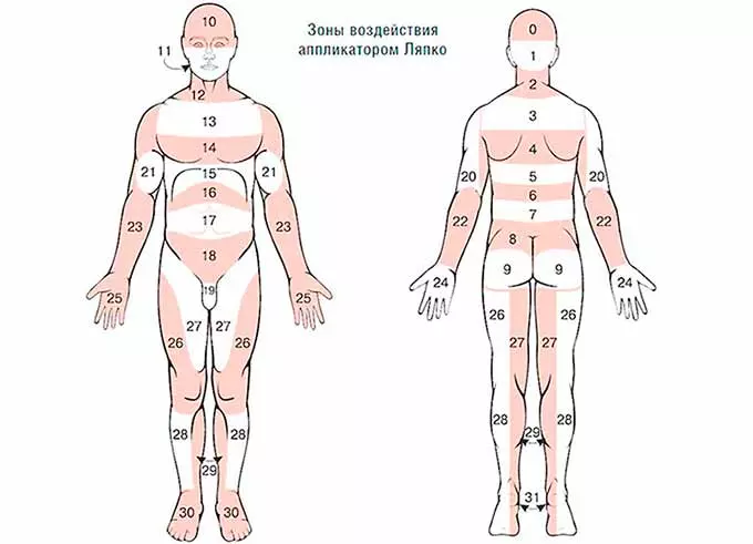 схема воздействия аппликаторами ляпко