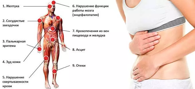 признаки больной печени