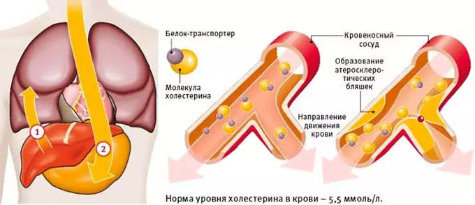 холестерин в крови