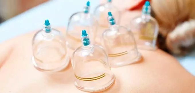 банки на спине