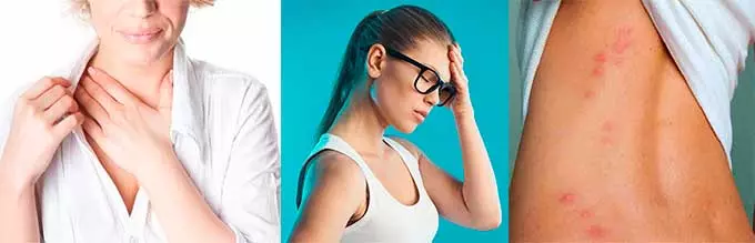 аллергия на лекарство