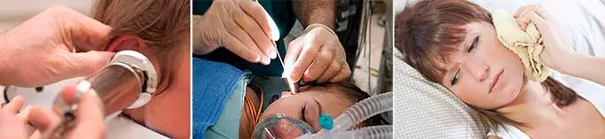 Особенности терапевтической тактики лечение уха