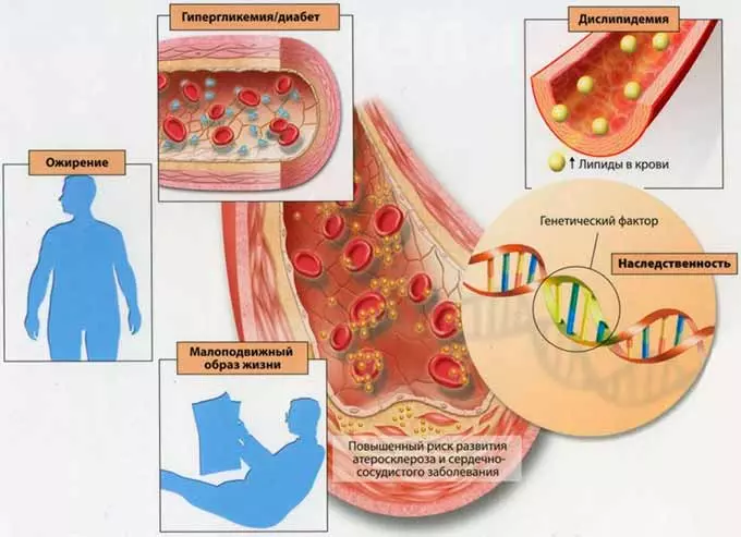 Причины патологического состояния факторы риска сердечно-сосудистых болезней