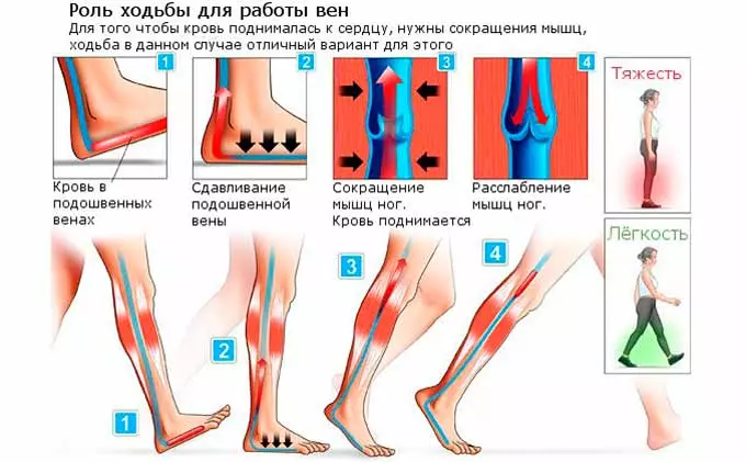 роль ходьбы для работы вен
