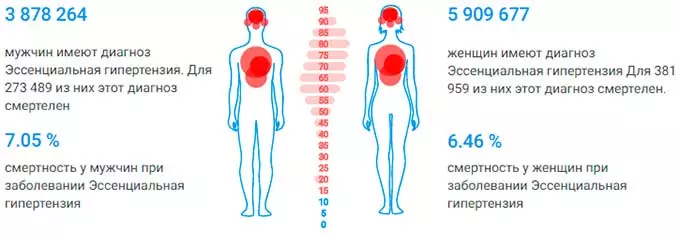 Эссенциальная гипертония