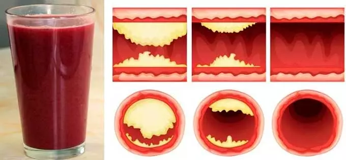 Сок для чистки сосудов