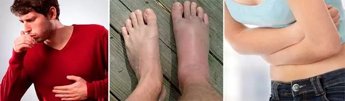 Симптомы при передозировке Симптомы побочного проявления от лекарств