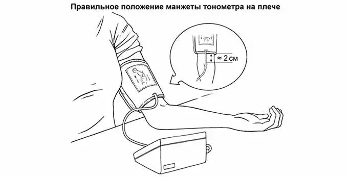 Правильное положение манжеты тонометра на плече
