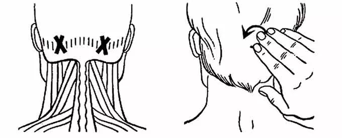 БАТ на затылочной зоне