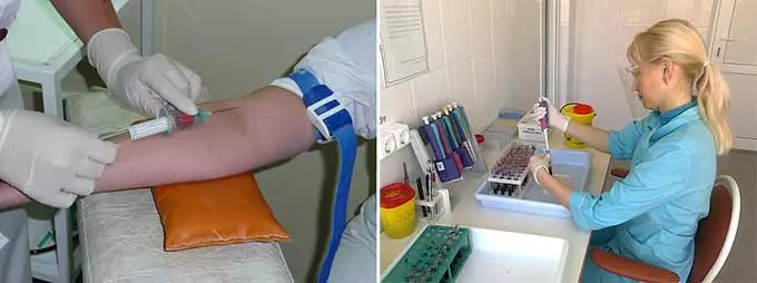 Забор венозной крови для исследования