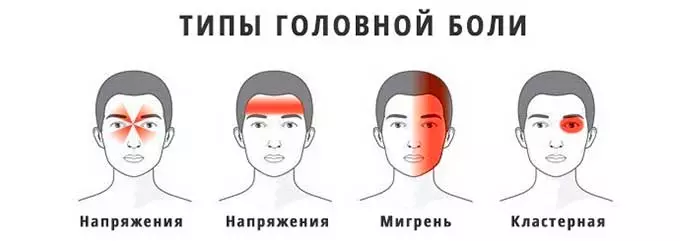 Типы головных болей