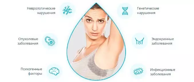 Причины гипергидроза