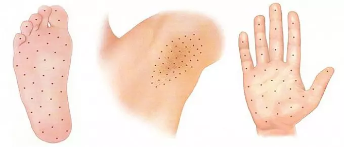 Зоны на теле с сильным потоотделением