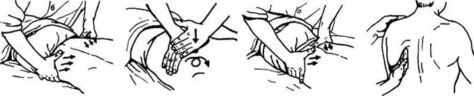 Классическая мануальная процедура Массаж спины