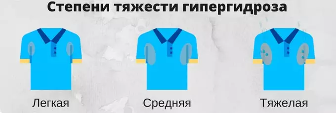 Степени тяжести гипергидроза